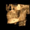 Immagine cefalometrica 3D