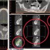 Strumenti di misurazione, annotazione e messa in evidenza di singole unità