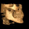 Immagine cefalometrica 3D