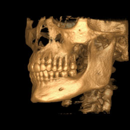 tac-cephalometric.jpg