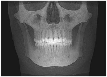 tac-frontal.jpg